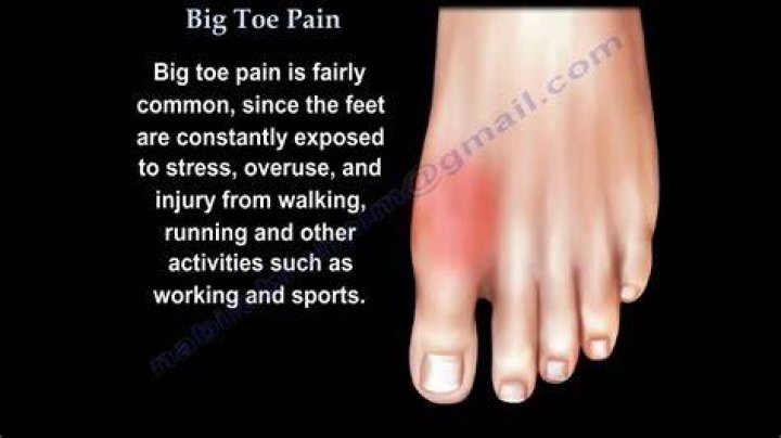 Why does my big toenail hurt when I put pressure on?