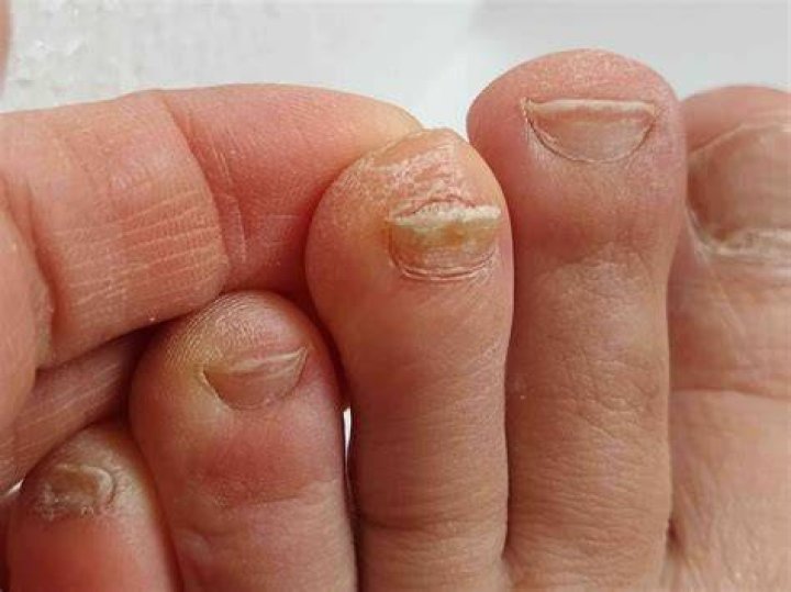 Why don't my toenails grow?