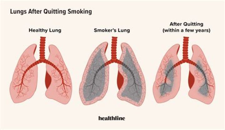 Why is breathing worse after quitting smoking?