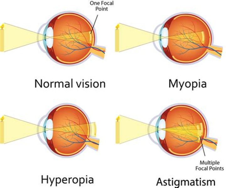 Why is my farsightedness getting worse?