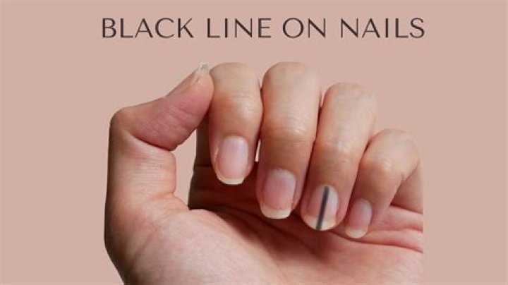 Why nails are becoming black?