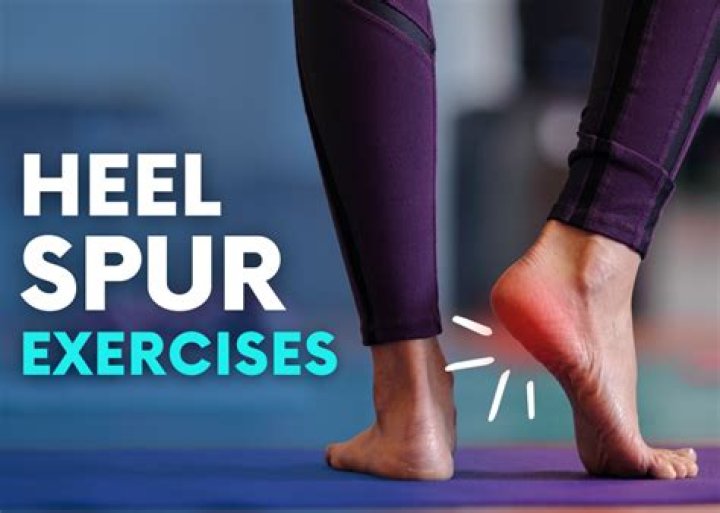 Will a cortisone shot help a heel spur?