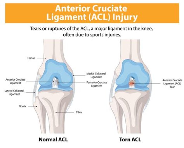 Will ligaments heal on their own?