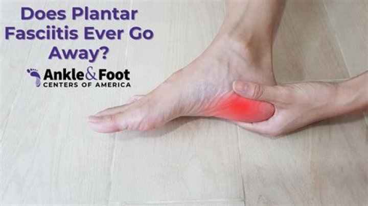 Will plantar fasciitis ever go away?