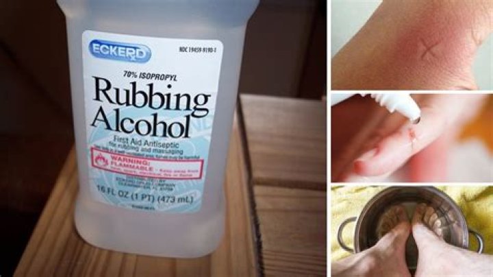Will rubbing alcohol clean resin?